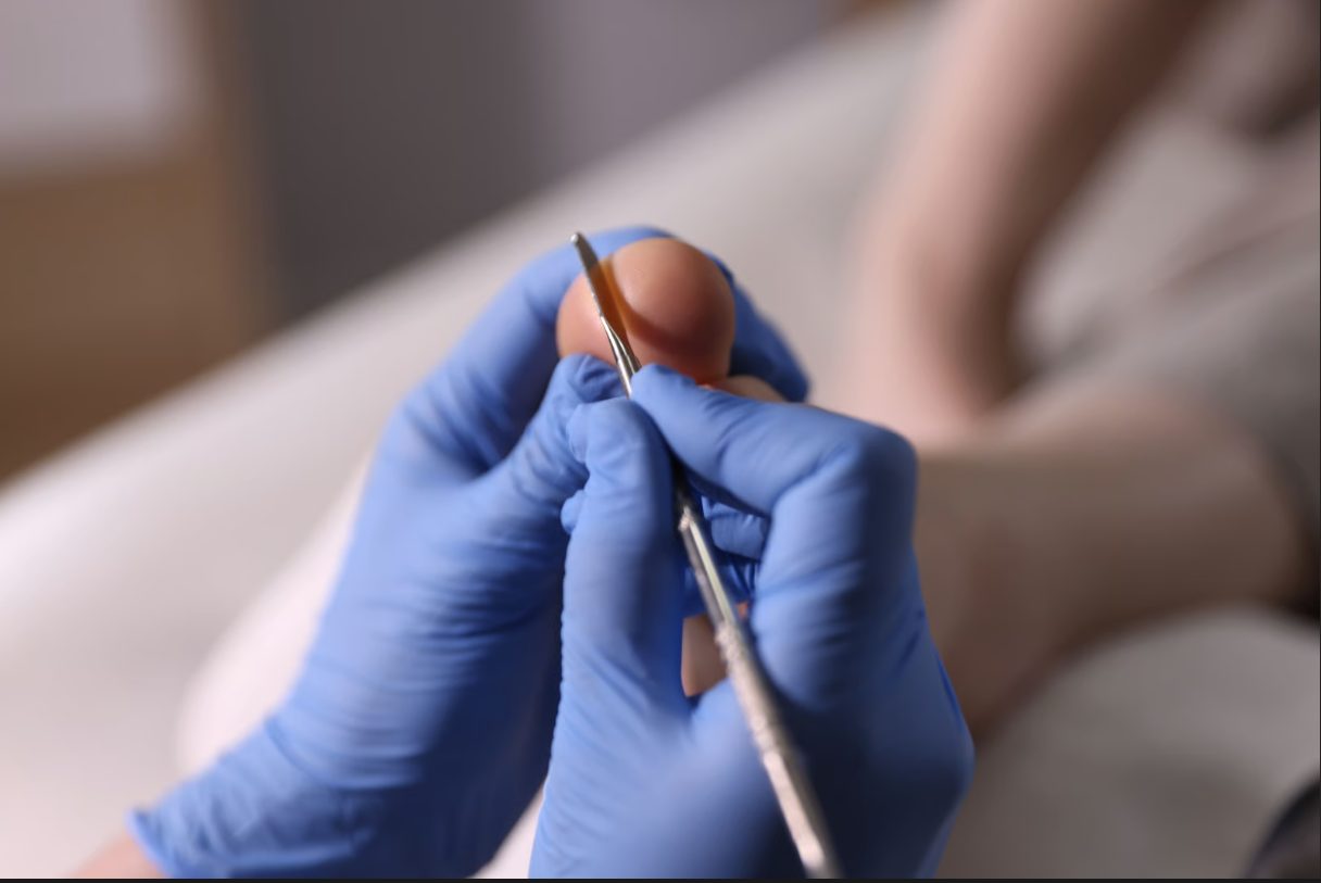 Podiatric examination for toenail discomfort